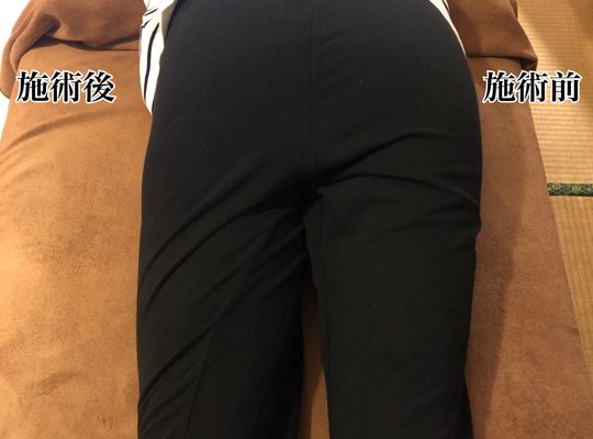 施術後